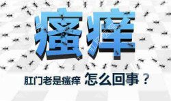肛門瘙癢治不好嗎？先檢查病因就好辦！